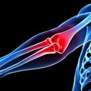 aa4e-progrevanie-loktevogo-sustava