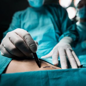 most-common-plastic-surgery-complications_thumb